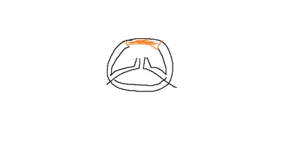 오버워치 2